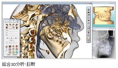 総合3D分析・診断