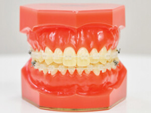 セラミックブラケット